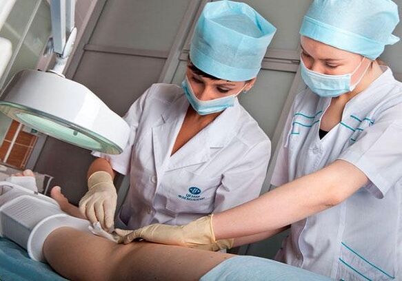 surgical treatment of varicose veins
